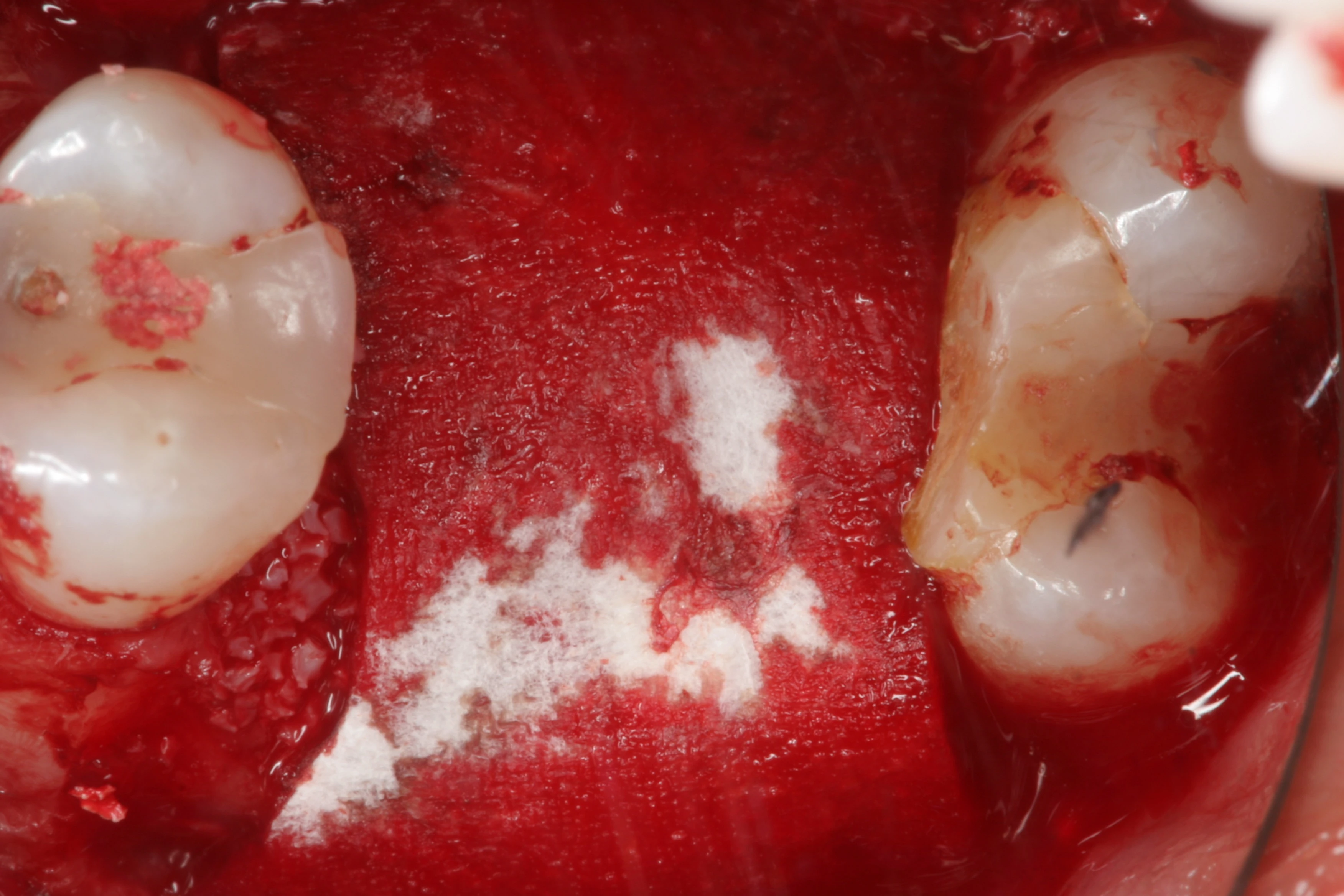 Surgery Image 4