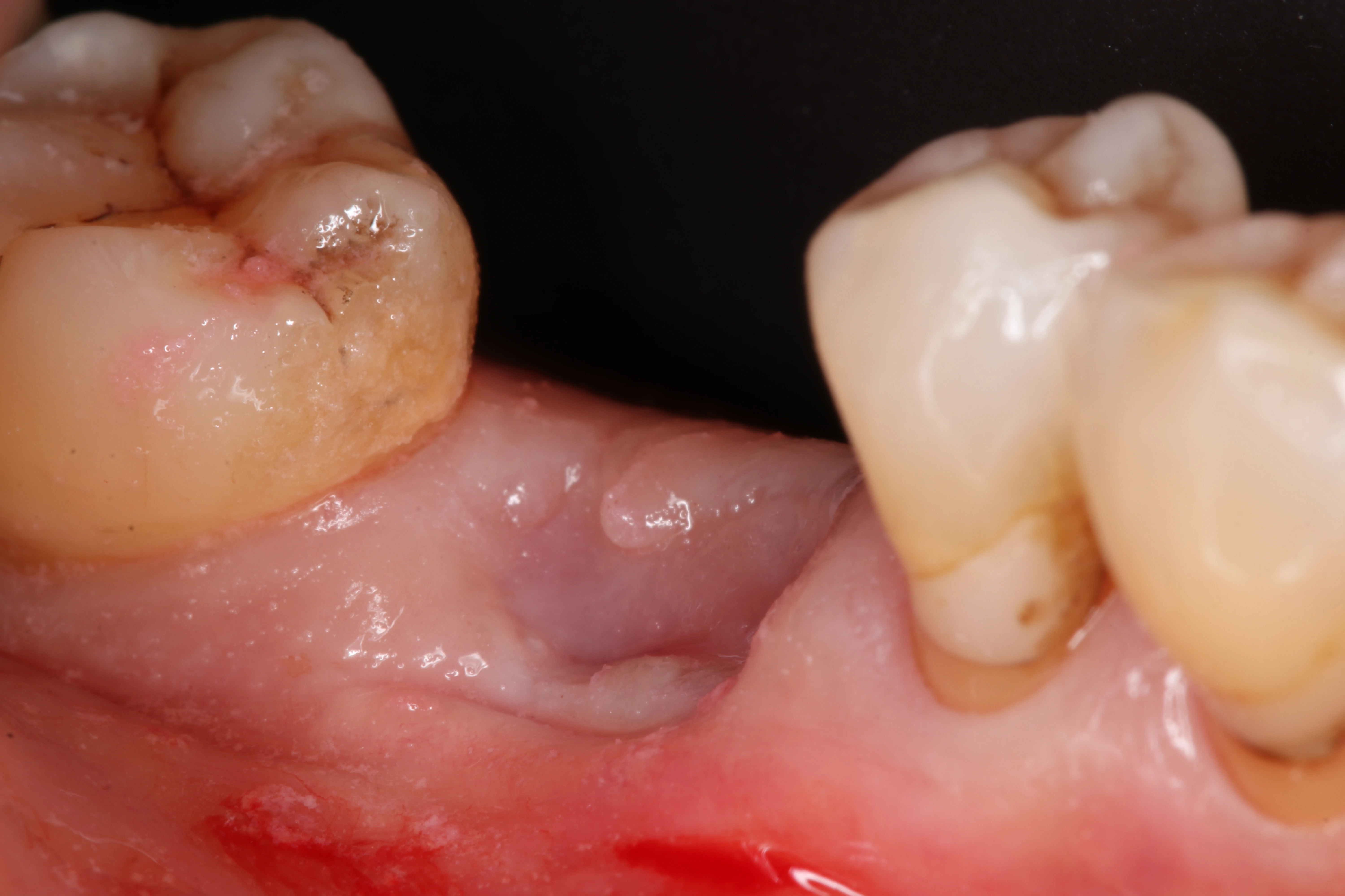 Surgery Image 1