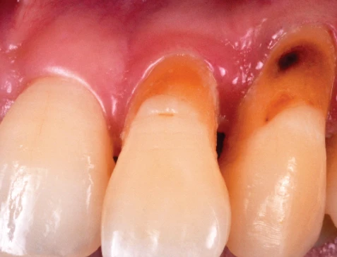 Surgery Image 1