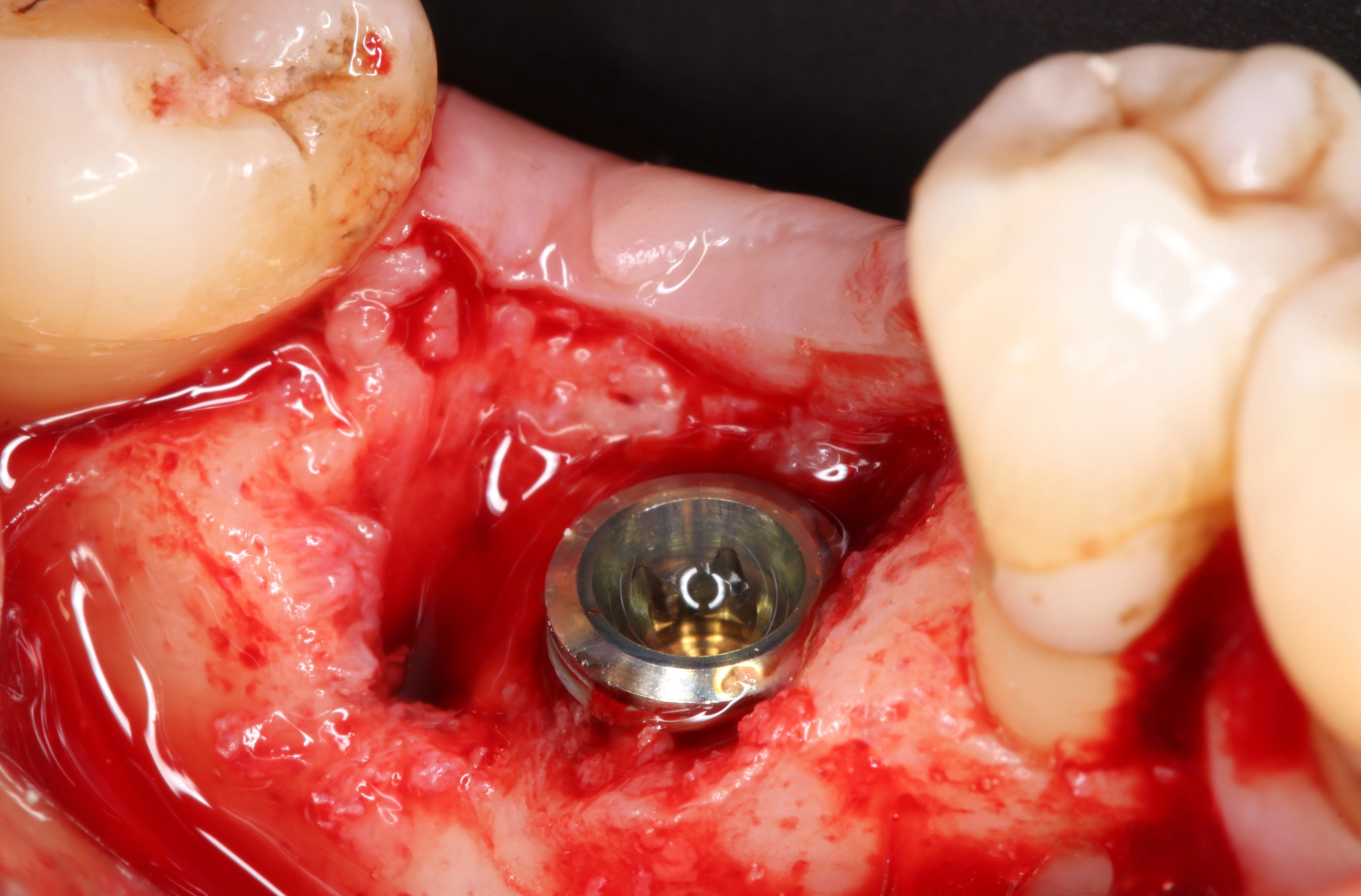 Surgery Image 2