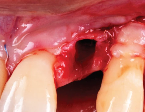Surgery Image 2