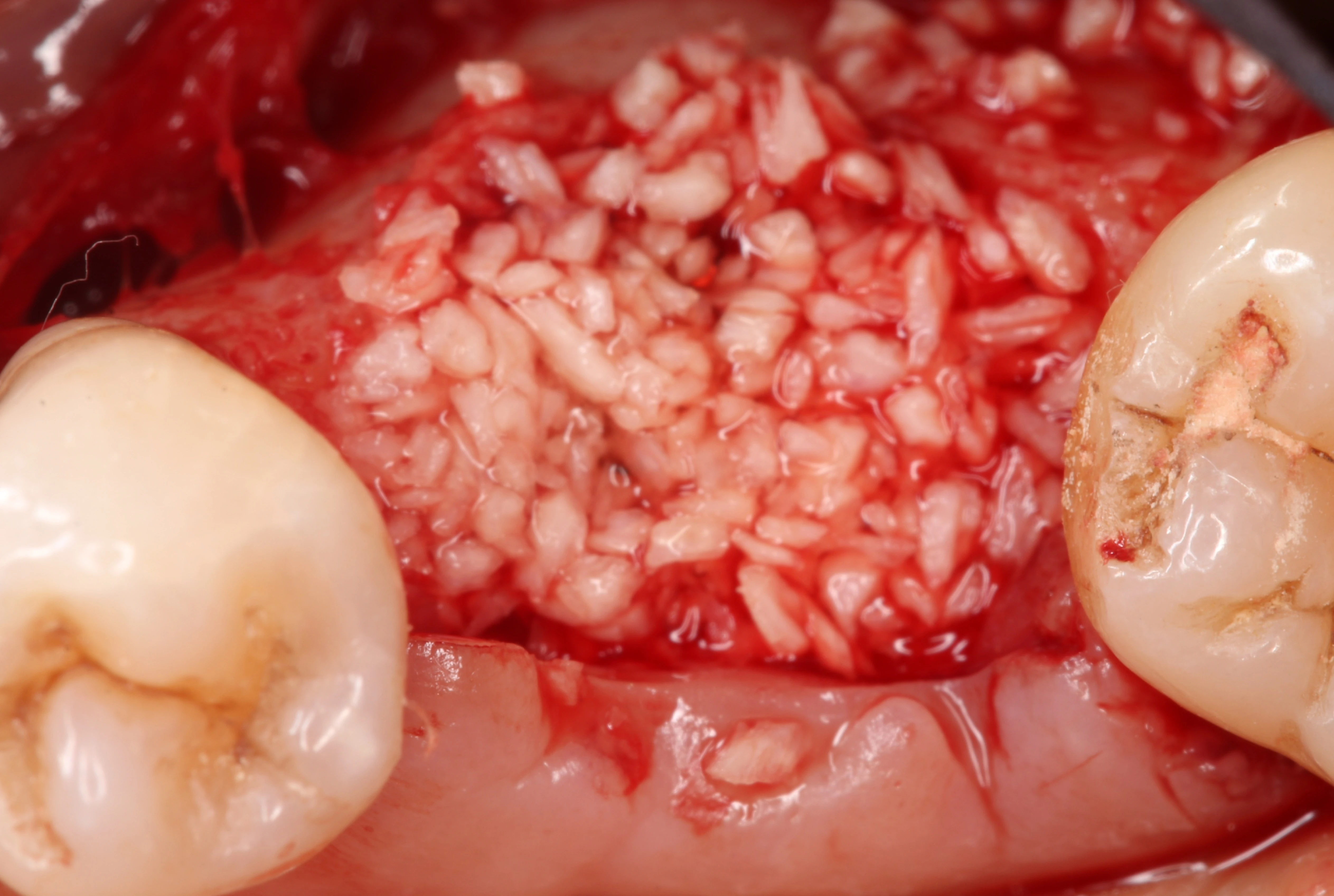 Surgery Image 3