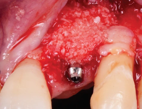 Surgery Image 3