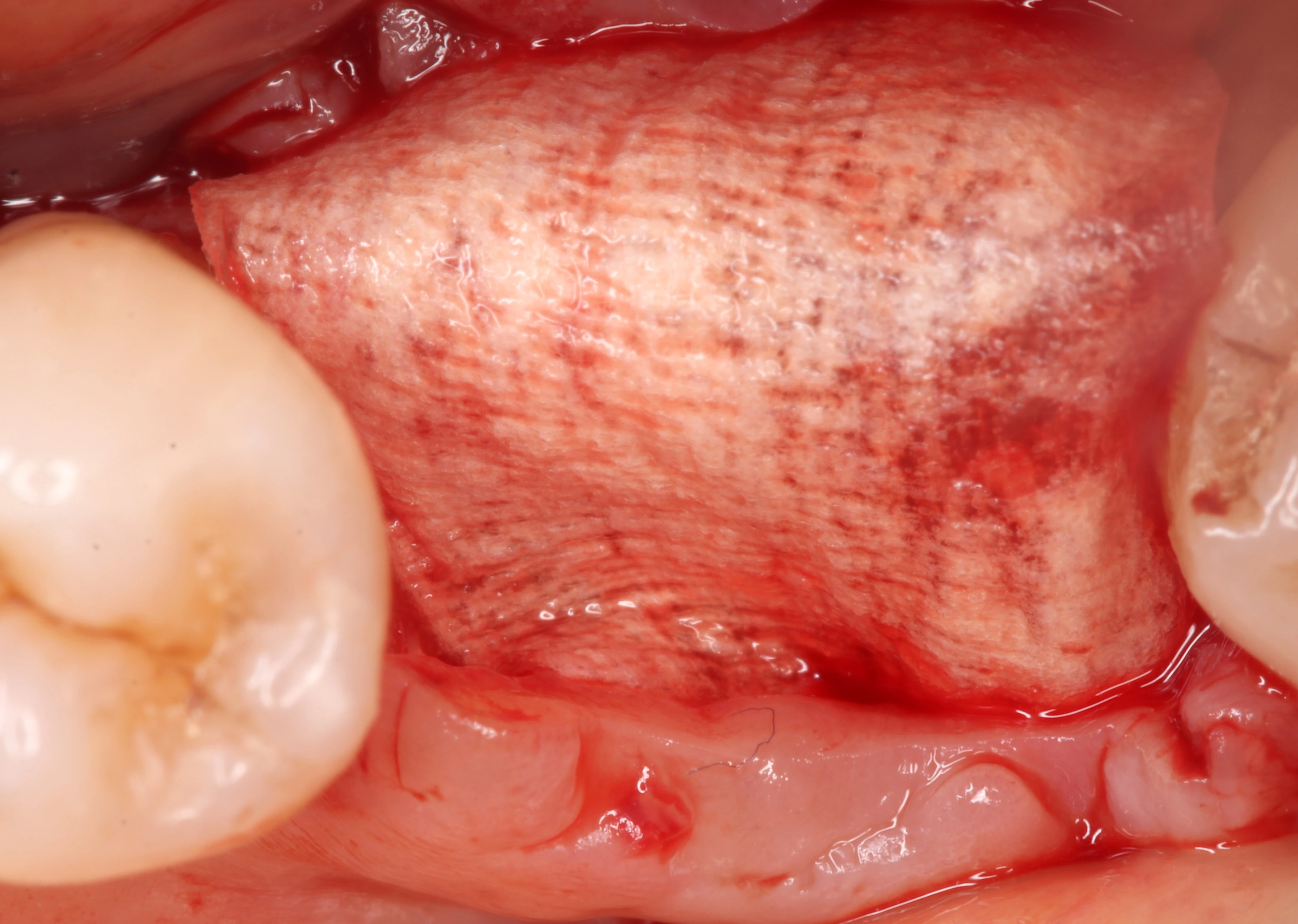 Surgery Image 4