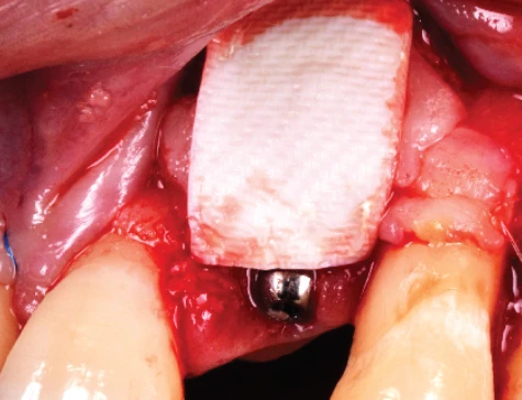 Surgery Image 4