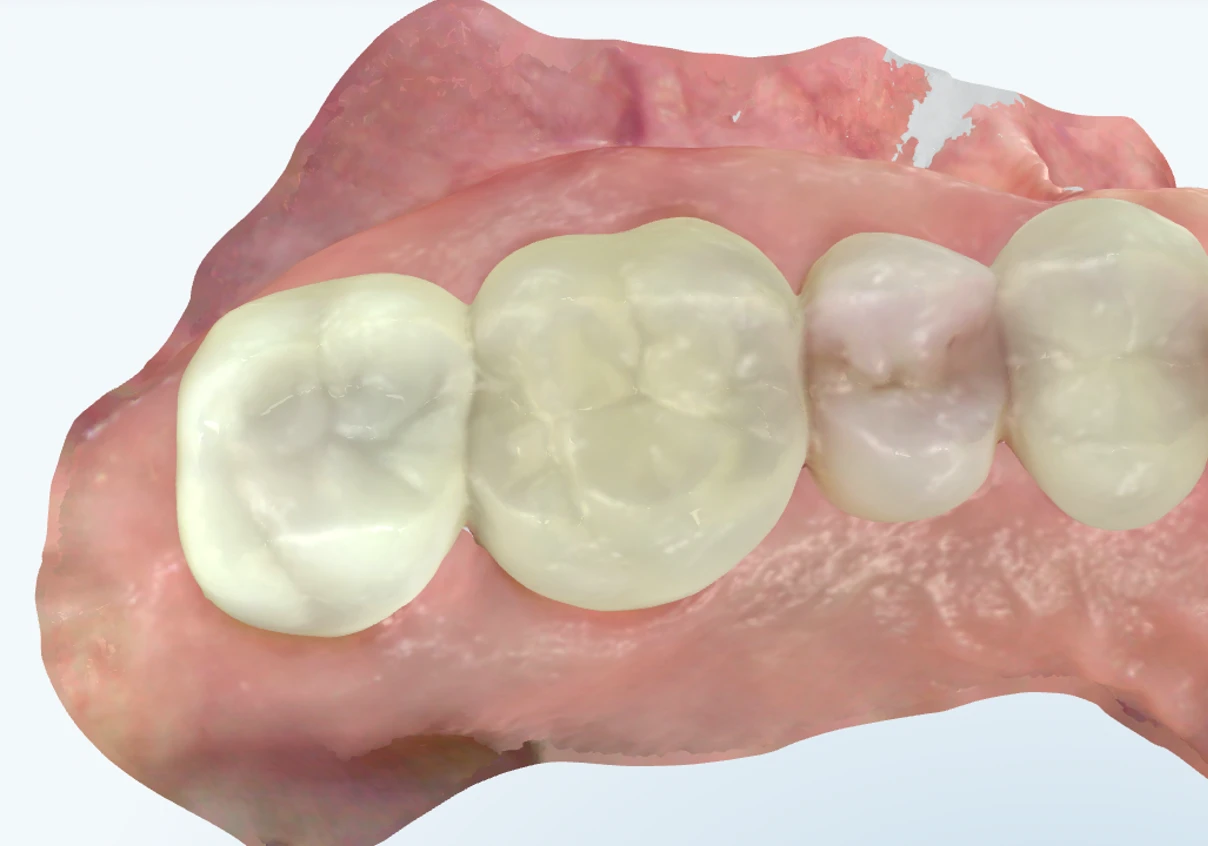 Surgery Image 1