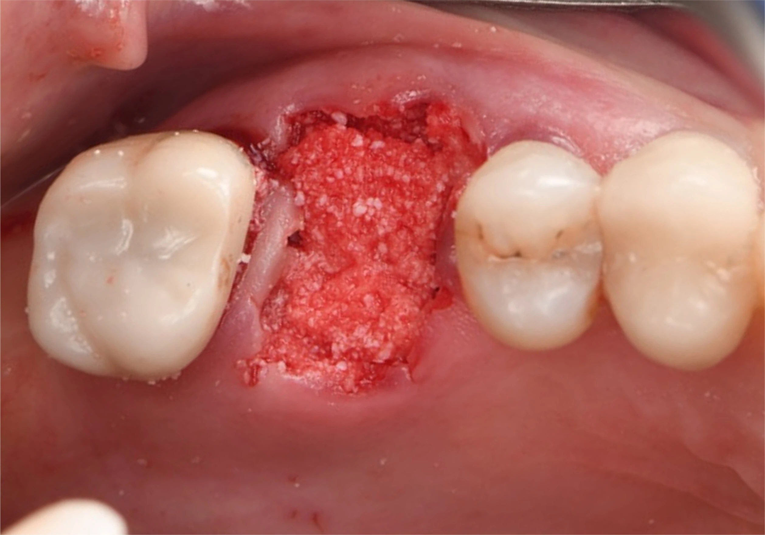 Surgery Image 2