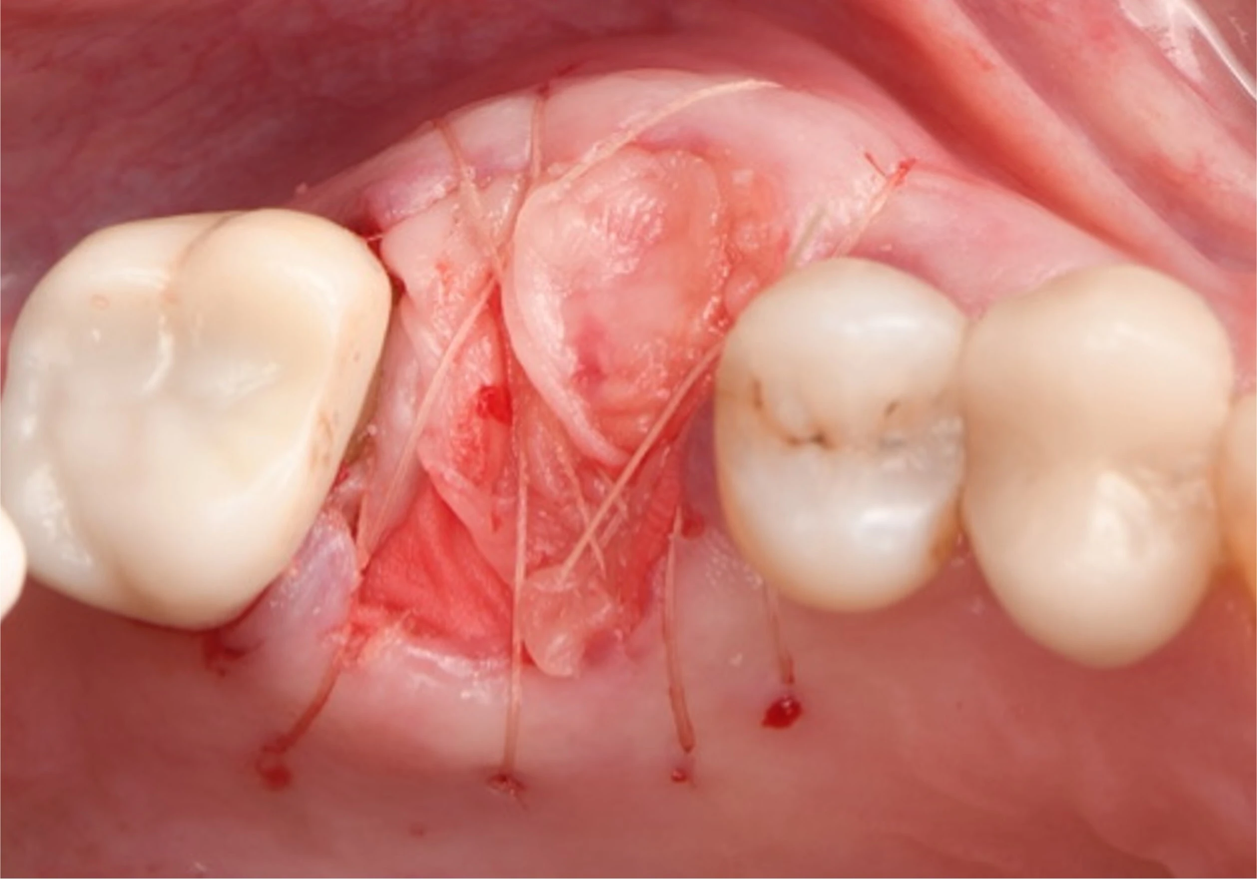 Surgery Image 3