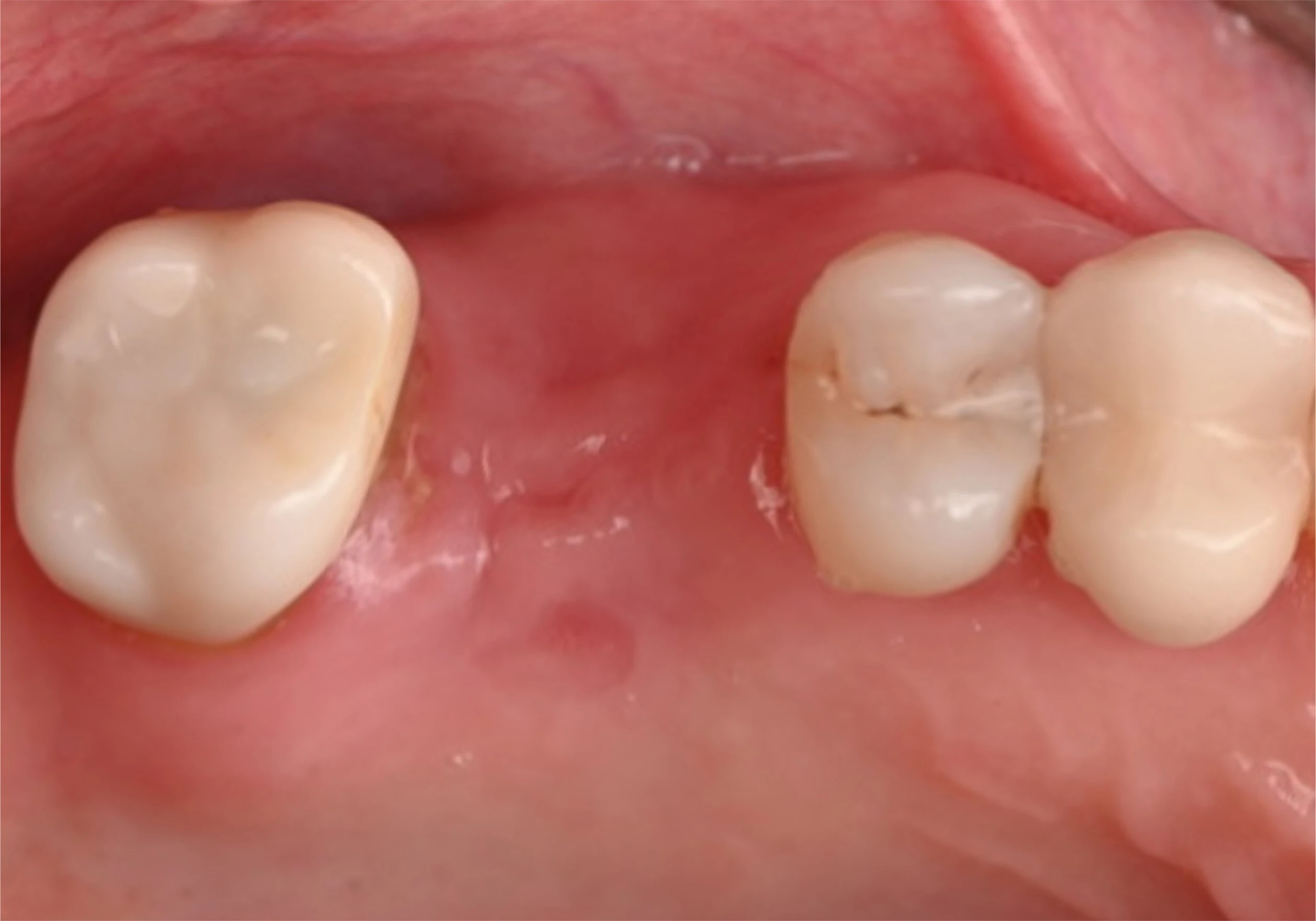 Surgery Image 4