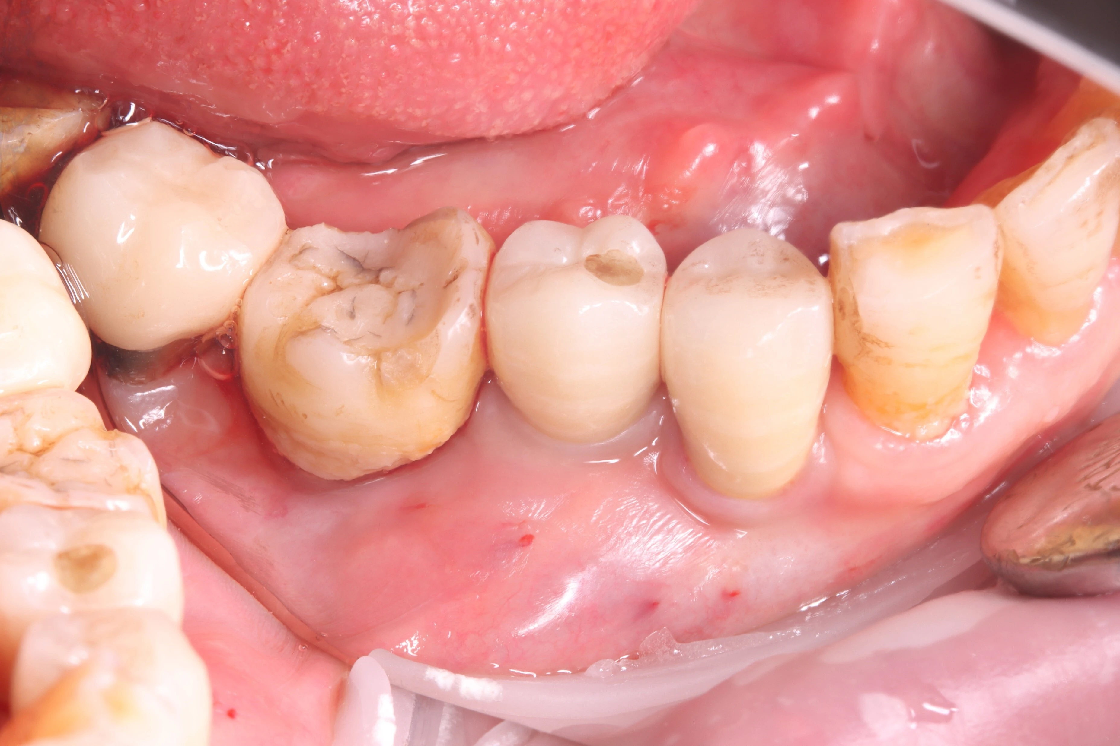 Surgery Image 1