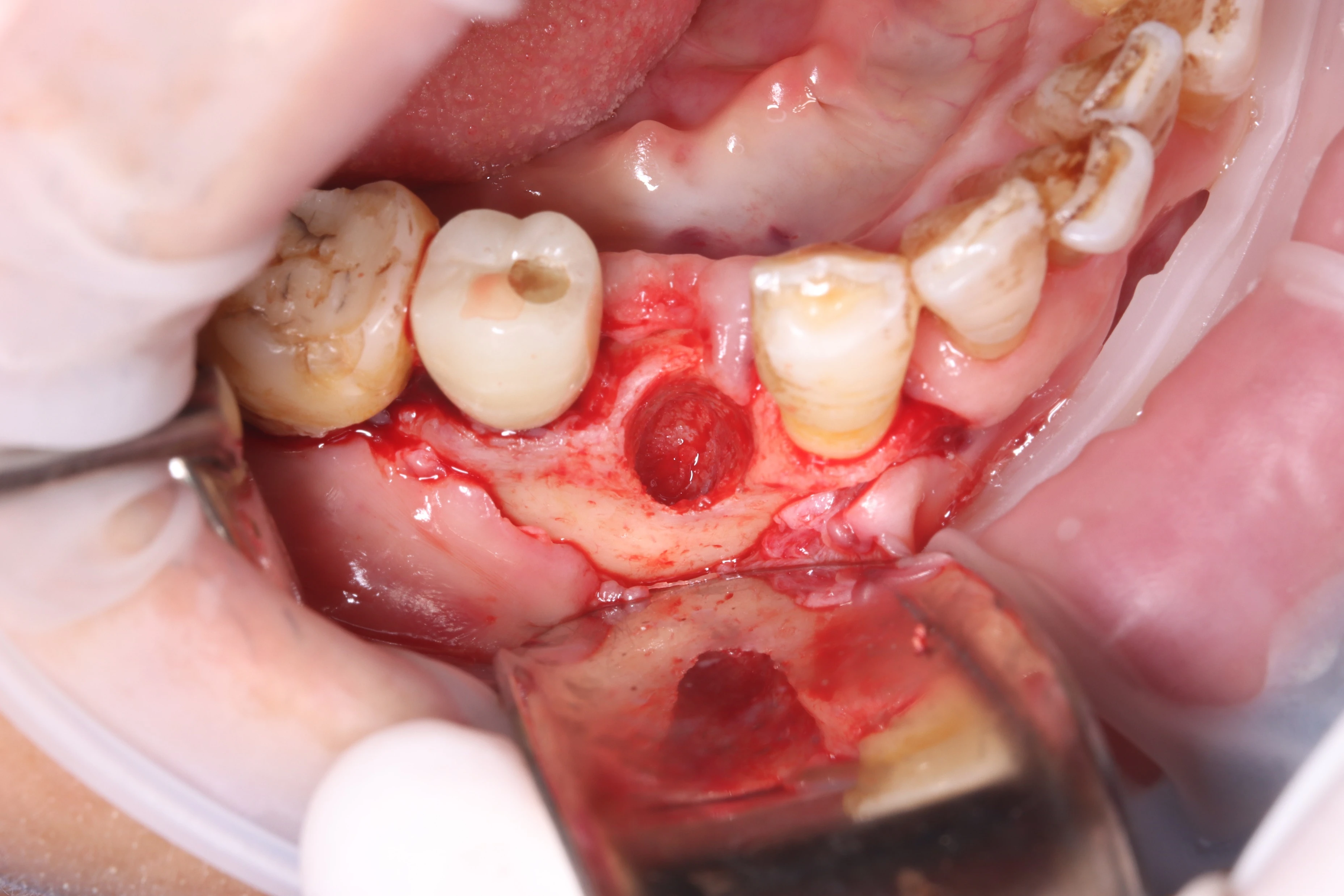 Surgery Image 2