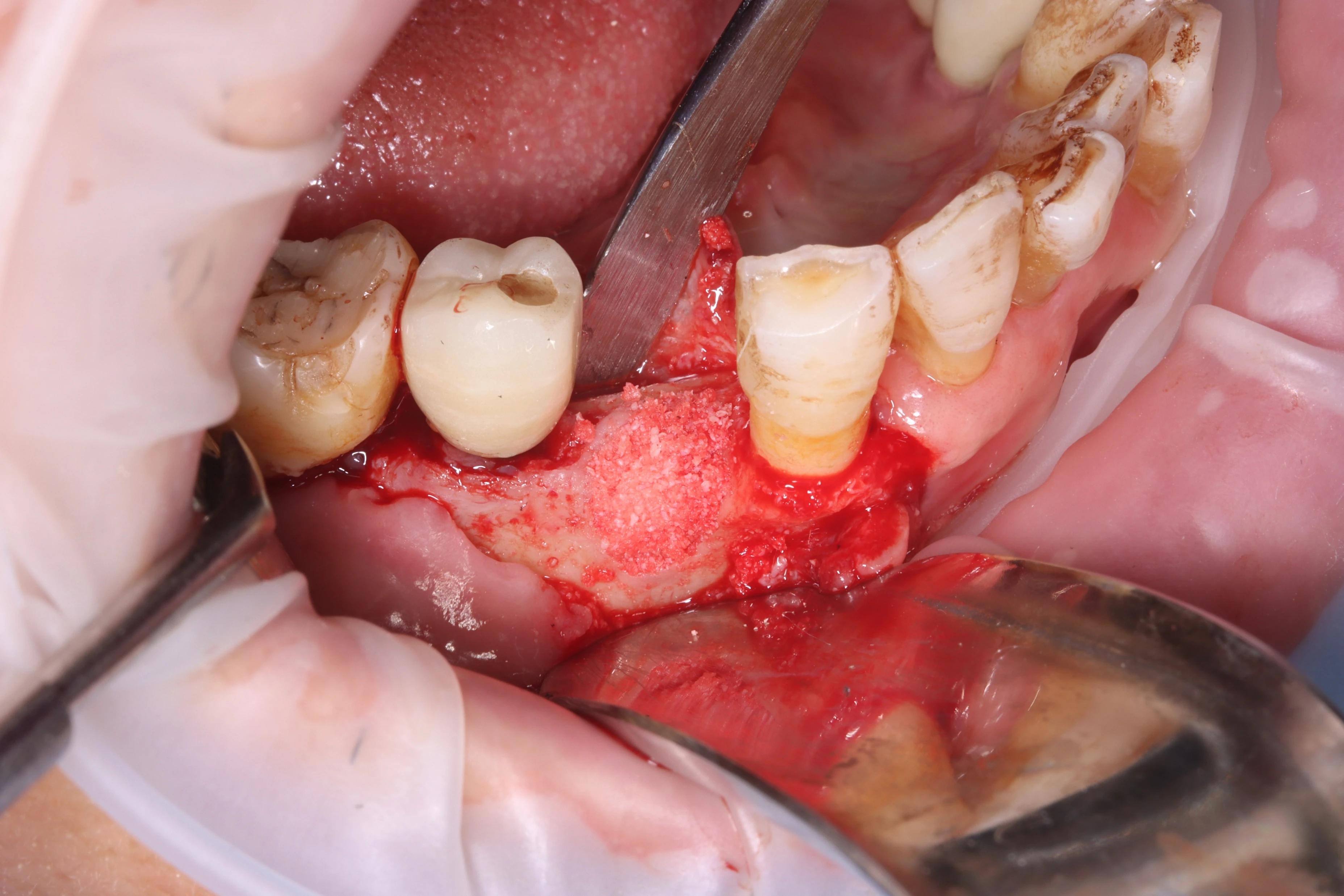 Surgery Image 3