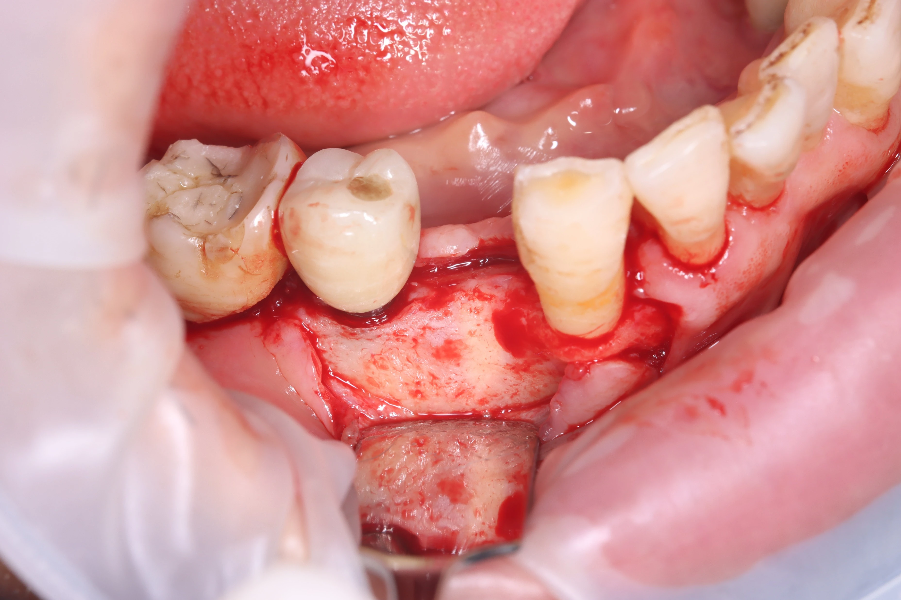Surgery Image 4