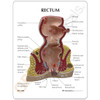 Rectum Model Description Casrd