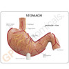 Stomach Ulcer Model Description Card
