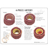 Artery Model Description card