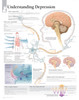 Depression Anatomical Chart