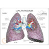 Lung Model Description Card