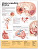 Stroke Poster