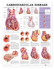 Cardiovascular Disease Anatomical Chart