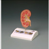 Kidney Stone Anatomical Model