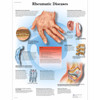 Rheumatic Diseases Anatomy Poster