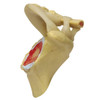 Shoulder Osteoarthritis Anatomical Model