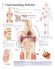 Osteoarthritis Poster