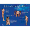 Intramuscular Injection Sites