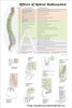 Subluxation Poster