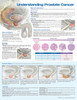 Prostate Cancer Poster