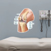 Knee Joint and Ligaments Poster