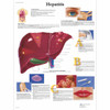 Hepatitis Anatomical Poster