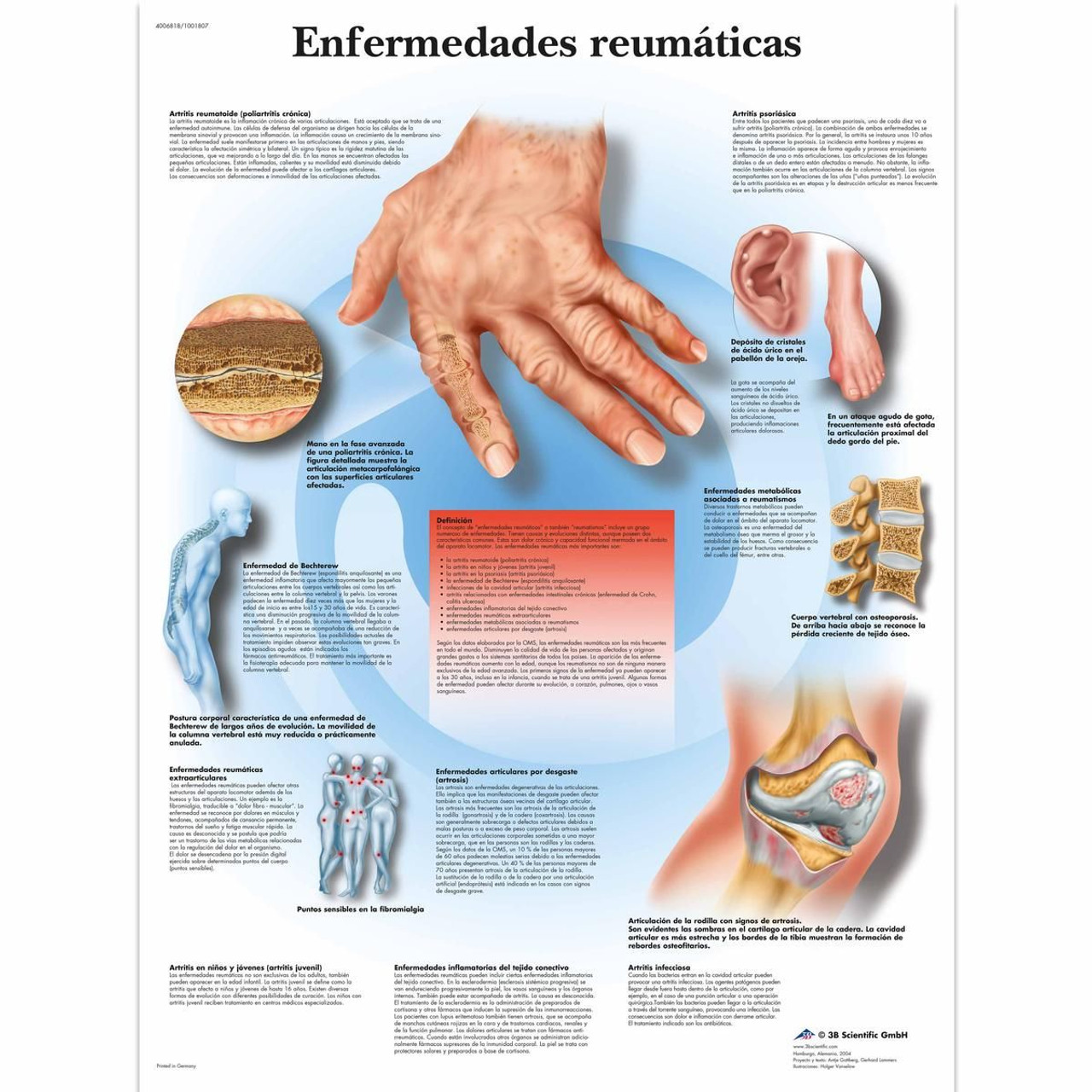 Enfermedades Reumáticas Poster