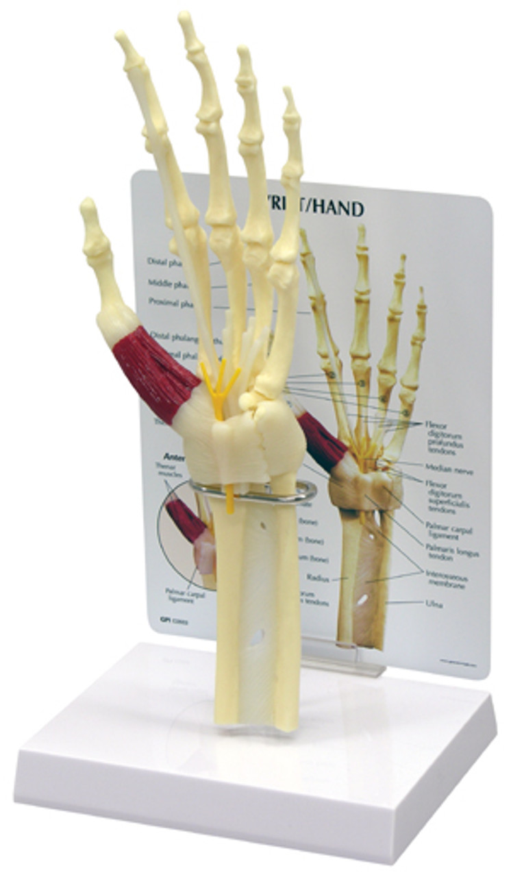 Carpal Tunnel Syndrome Hand and Wrist - Anatomical Model