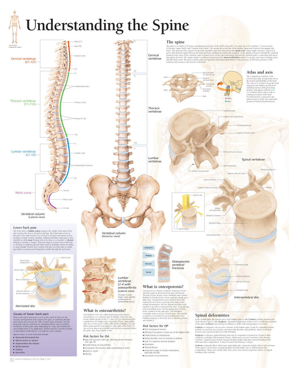 Understanding The Spine Poster Clinical Charts And Supplies 7284