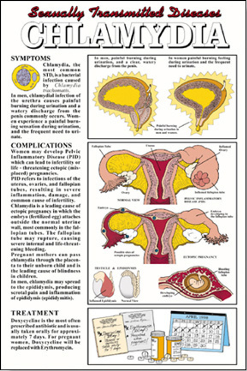 Chlamydia Poster