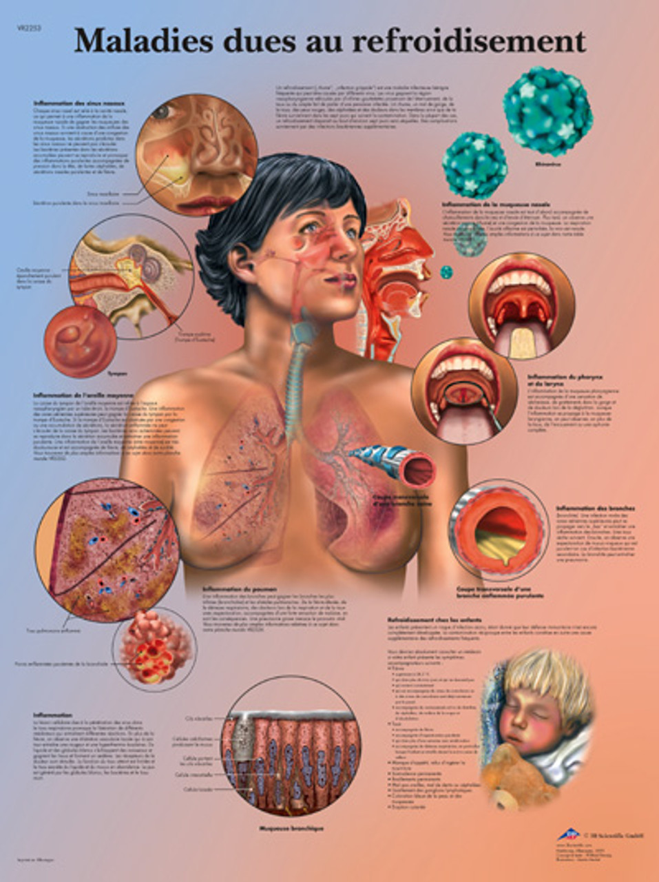 Maladies dues au refroidisement Poster