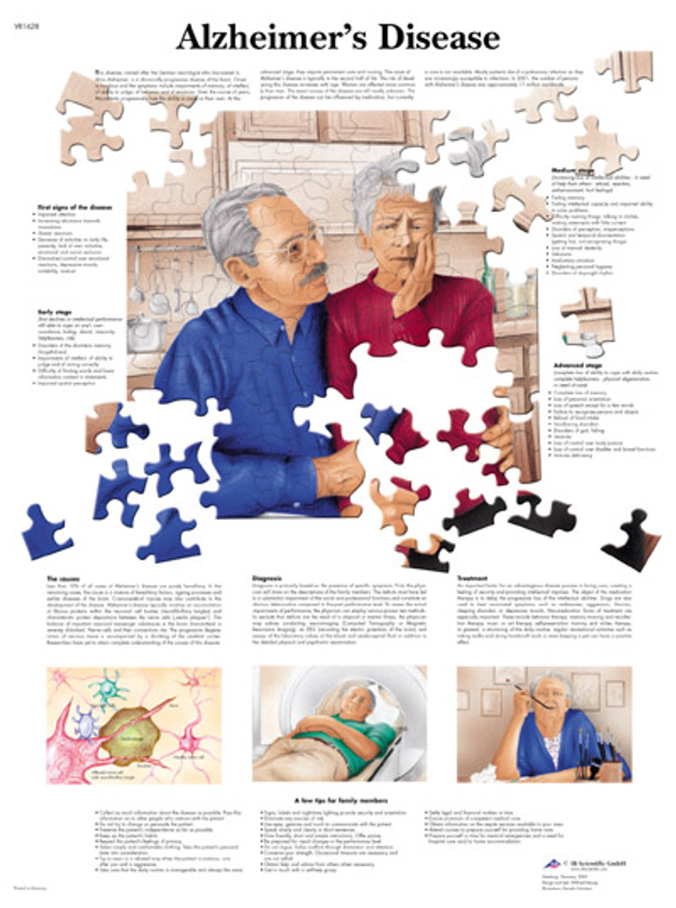 Alzheimer's Disease Chart