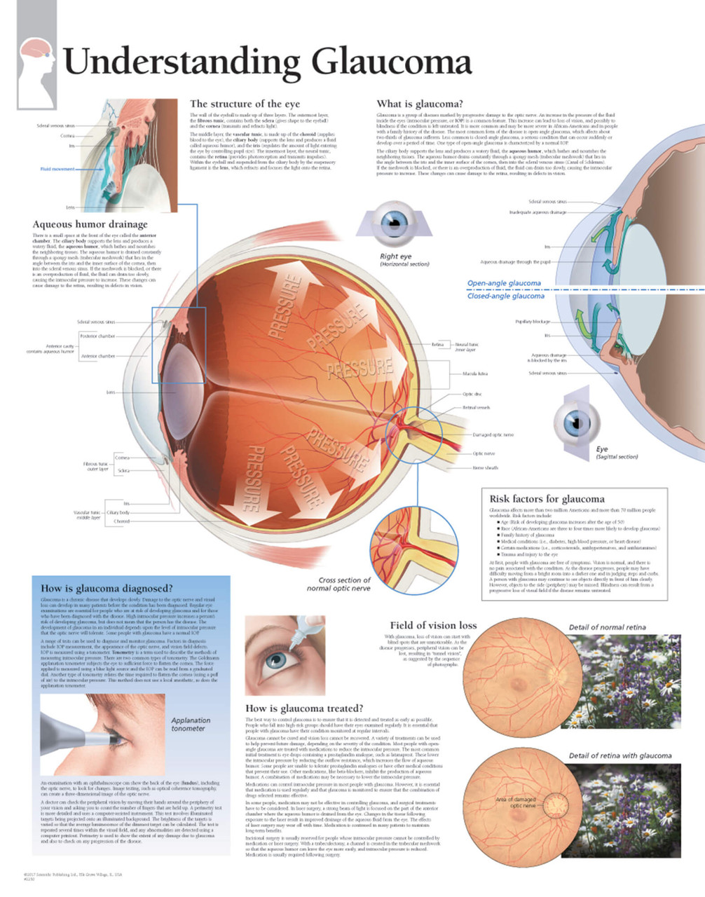 Eye Glaucoma Poster