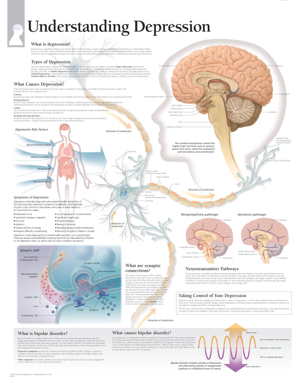 Depression Anatomical Chart