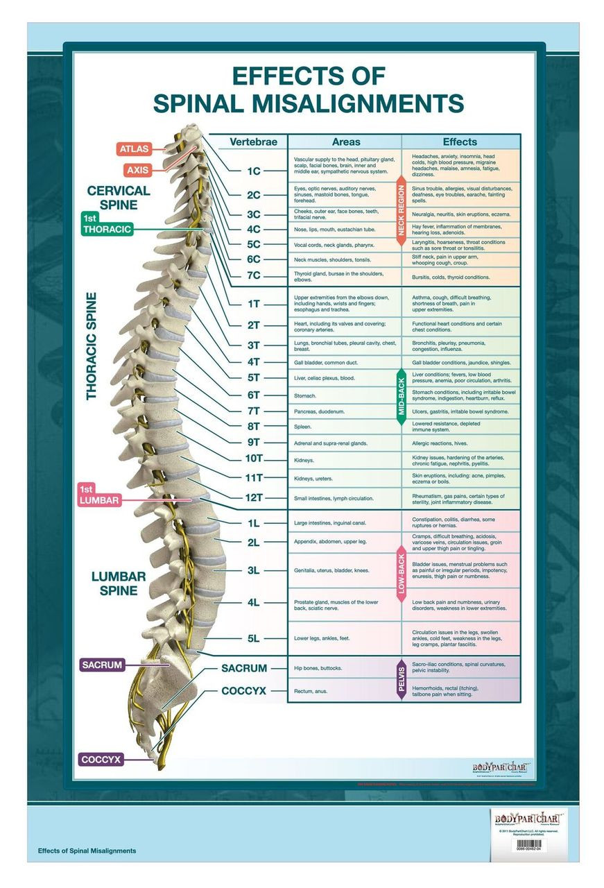 Spinal Misalignment Chart