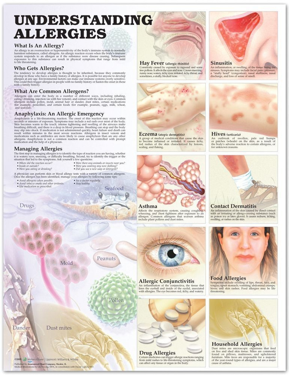 The Skin And Common Disorders Anatomical Chart