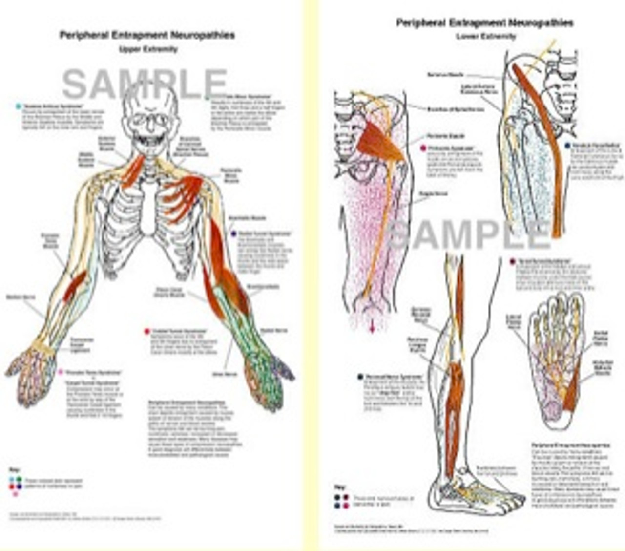 Peripheral Entrapment Neuropathies Anatomical Poster