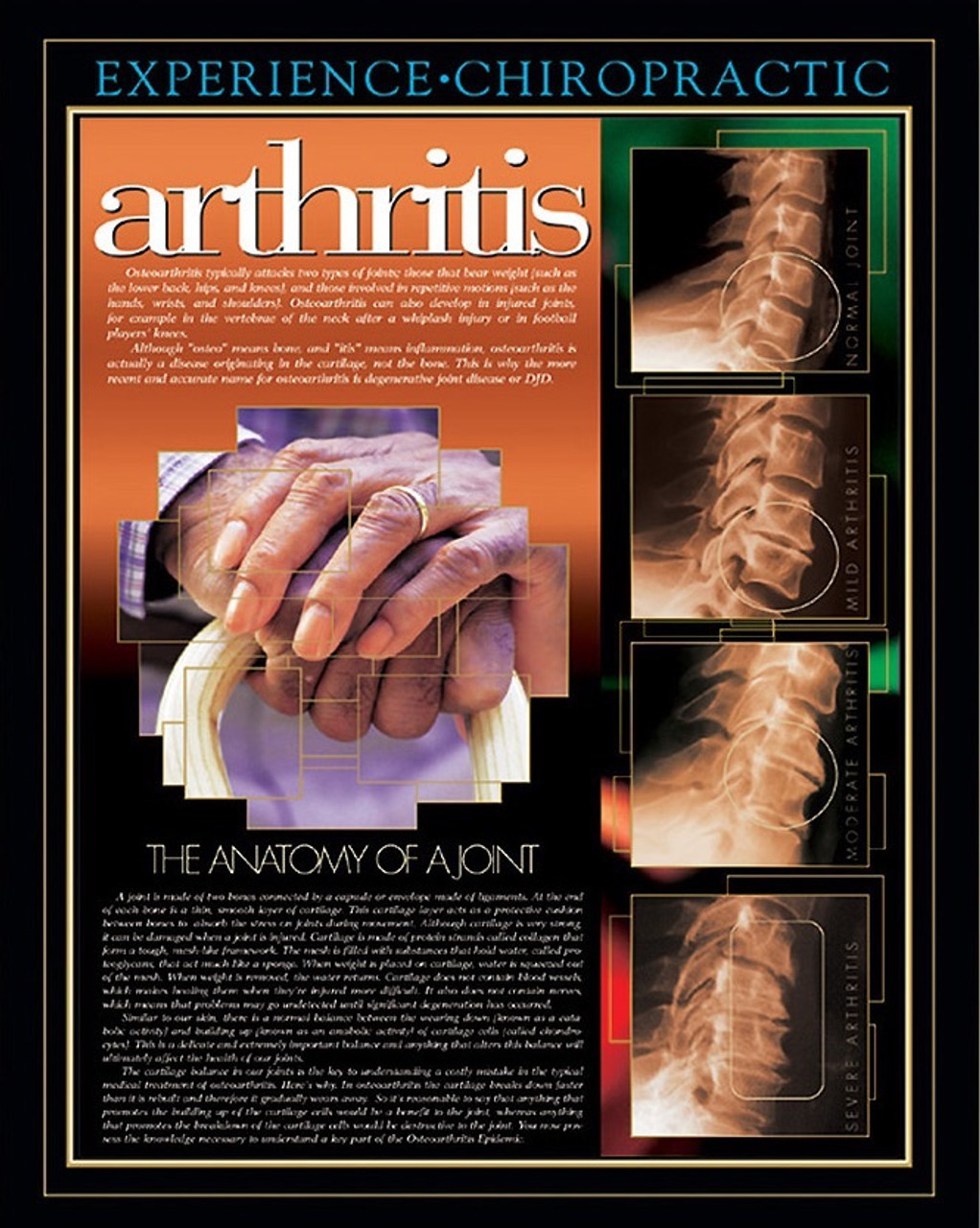 Arthritis Chiropractic Poster - Clinical Charts and Supplies