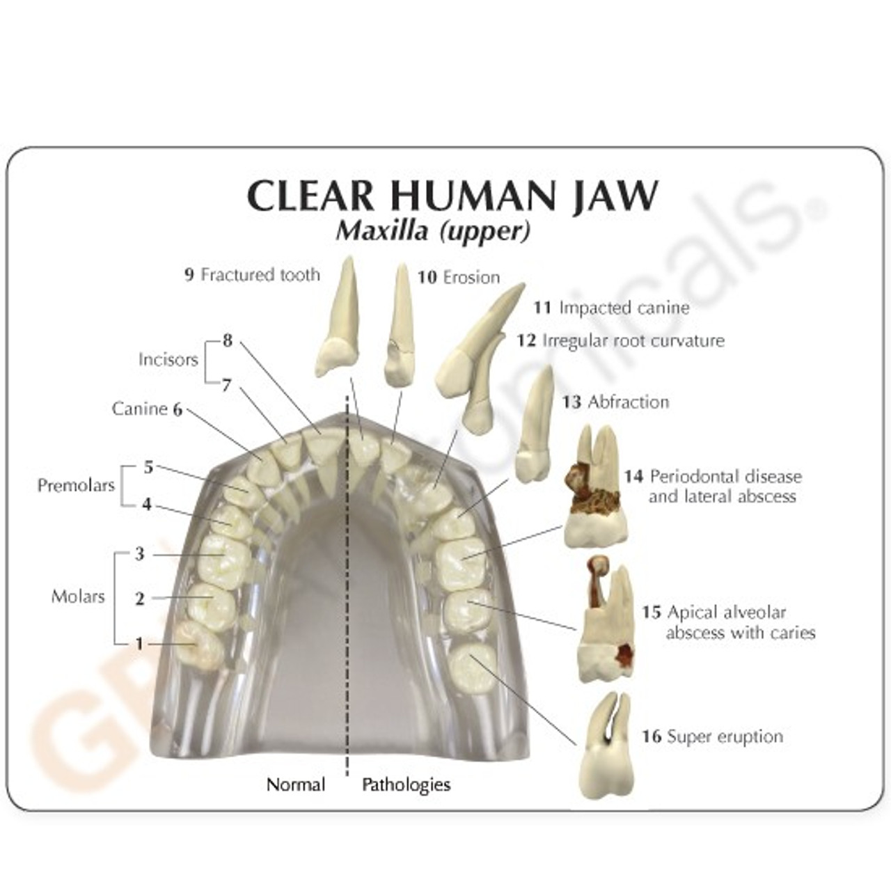 Jaw Model Description Card