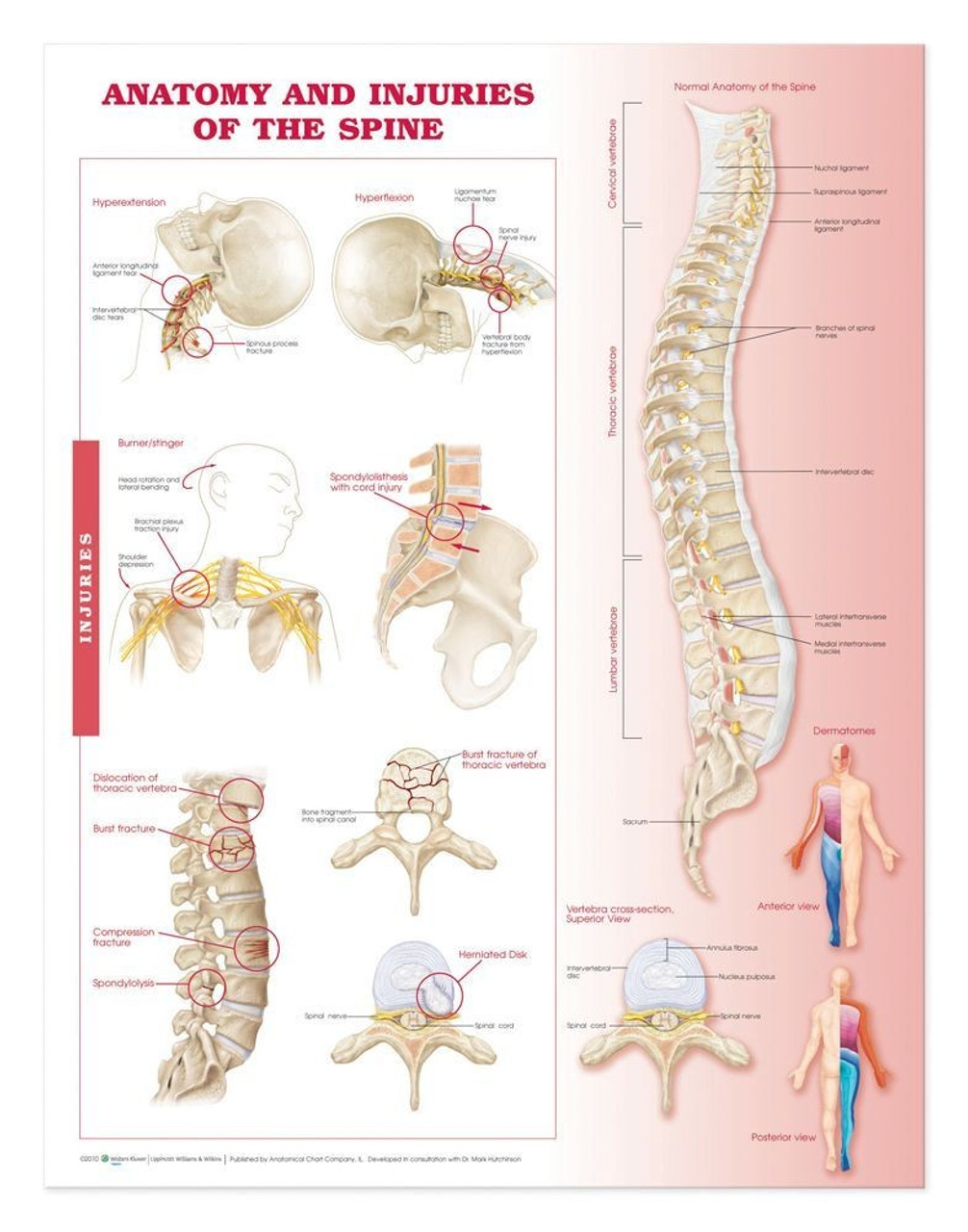 Spine injuries poster