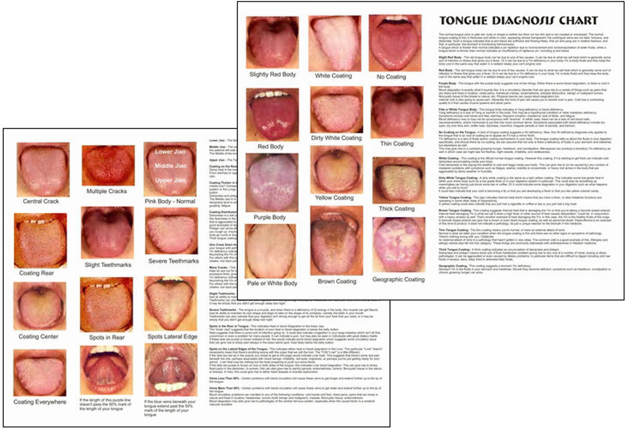 Tongue Health Chart