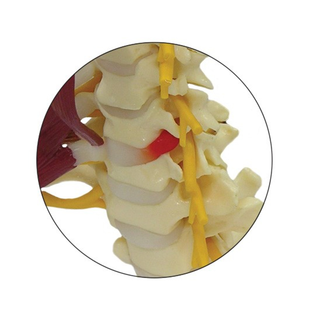 Cervical Vertebrae Model Disc View