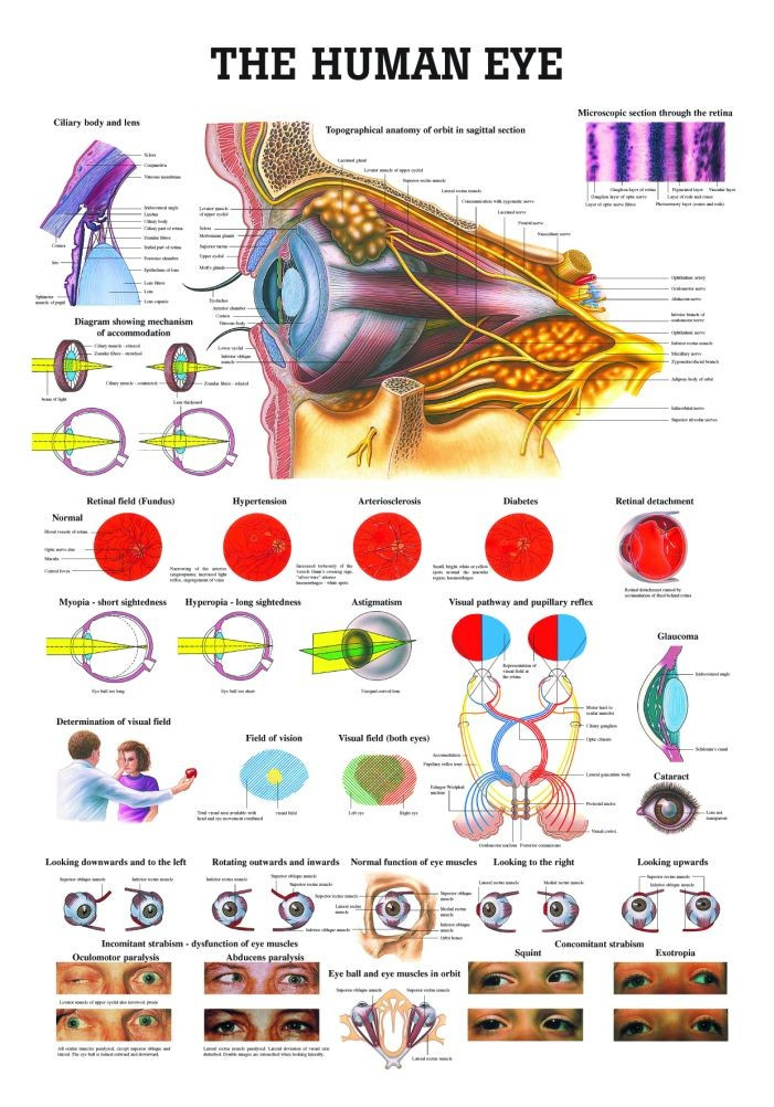 Anatomie-Poster „Disorders Of The Eye“ – 50,8 X 66 Cm, Laminiert, Für Klassenzimmer, Praxis, Studium